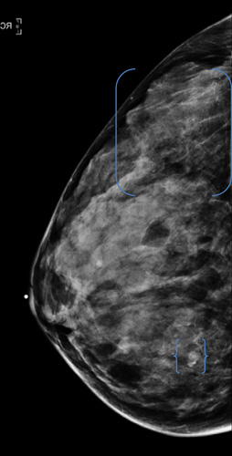 Microsoft PowerPoint - EKA.RSNApressimages.2012.10.08.pptx