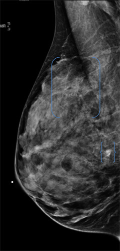 Microsoft PowerPoint - EKA.RSNApressimages.2012.10.08.pptx